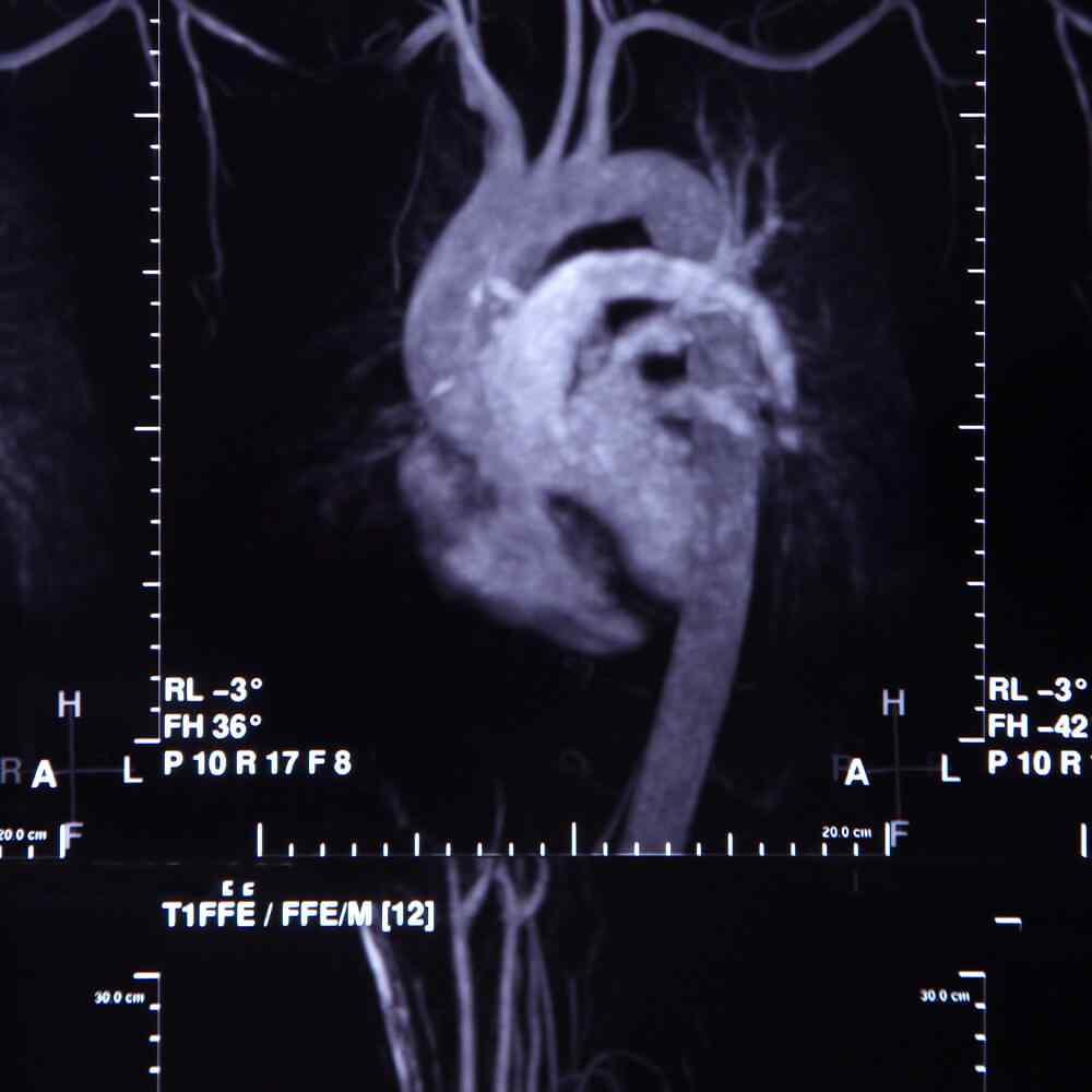 http://phgns.fr/wp-content/uploads/2021/08/inner_image_05.jpg